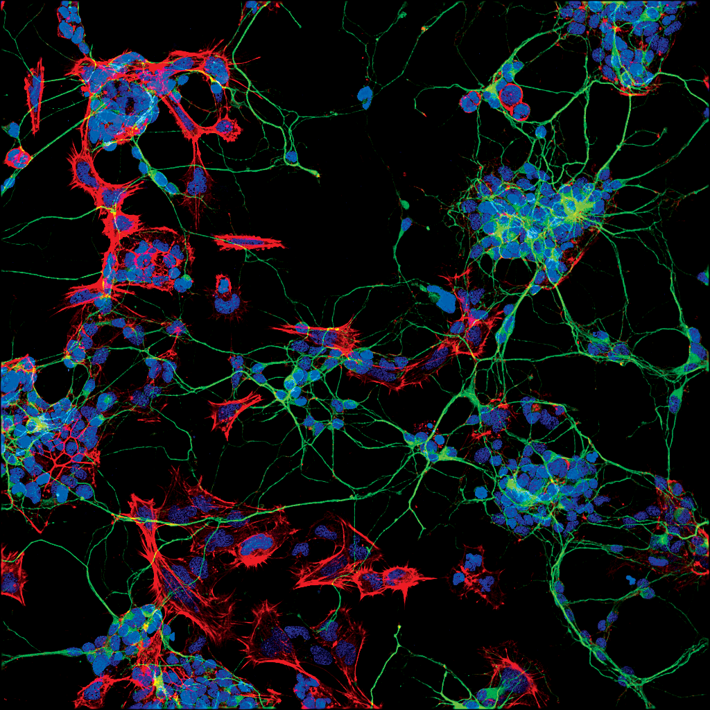 waking consciousness